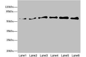 Western blot All lanes: PIP5K1B antibody at 5. (PIP5K1B antibody  (AA 190-470))