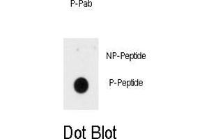Image no. 1 for anti-Insulin Receptor (INSR) (pTyr1185) antibody (ABIN358482)