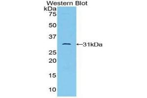 Western Blotting (WB) image for anti-TGF-beta Activated Kinase 1/MAP3K7 Binding Protein 1 (TAB1) (AA 189-439) antibody (ABIN1859749) (TAB1 antibody  (AA 189-439))