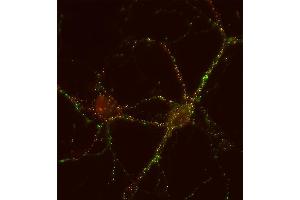 Indirect immunolabeling of PFA fixed rat hippocampus neurons with anti-synapsin 3 (1 : 500; red) and mouse anti-synapsin 1 (cat. (Synapsin III antibody  (AA 417-434))