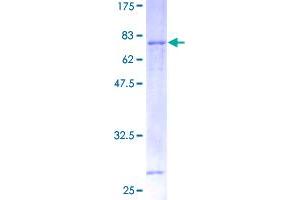 VEGFC Protein (AA 1-419) (GST tag)