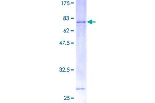 VEGFC Protein (AA 1-419) (GST tag)