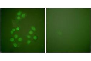 Immunofluorescence analysis of A549 cells, using CREB-BP Antibody. (CBP antibody  (AA 2393-2442))
