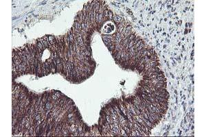 Immunohistochemistry (IHC) image for anti-TNF Receptor-Associated Protein 1 (TRAP1) antibody (ABIN1501500) (TRAP1 antibody)