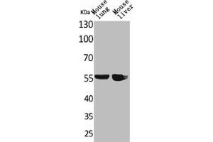 Western Blot analysis of mouse lung mouse liver cells using ALDH1A1 Polyclonal Antibody (ALDH1A1 antibody  (N-Term))