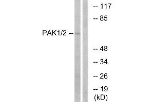 Western Blotting (WB) image for anti-P21 Protein (Cdc42/Rac)-Activated Kinase 1/2 (PAK1/2) (Ser199) antibody (ABIN1848058) (PAK1/2 antibody  (Ser199))
