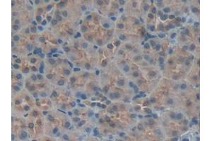 Used in DAB staining on fromalin fixed paraffin- embedded kidney tissue (IGFBP5 antibody  (AA 25-271))