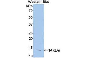 Western Blotting (WB) image for anti-Eukaryotic Translation Initiation Factor 4E Binding Protein 1 (EIF4EBP1) (AA 2-118) antibody (ABIN3202359) (eIF4EBP1 antibody  (AA 2-118))