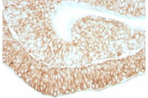 Formalin-fixed, paraffin-embedded human bladder stained with CD59 Mouse Monoclonal Antibody (193-27). (CD59 antibody)
