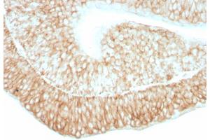 Formalin-fixed, paraffin-embedded human bladder stained with CD59 Mouse Monoclonal Antibody (193-27). (CD59 antibody)