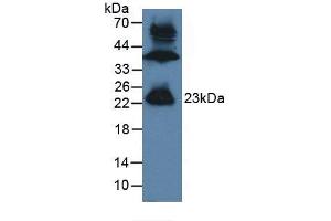 Western blot analysis of Mouse Testis Tissue. (GREM1 antibody  (AA 26-184))