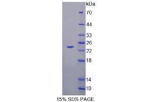 SDS-PAGE analysis of Human NCALd Protein. (NCALD Protein)