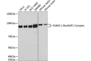 Western Blotting (WB) image for anti-Small Ubiquitin Related Modifier Protein 1 (SUMO1) antibody (ABIN7270373)