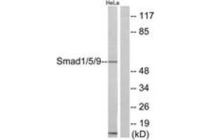 Western blot analysis of extracts from HeLa cells, using Smad1/5/9 Antibody. (SMAD1 antibody  (AA 10-59))