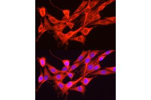 Immunofluorescence analysis of PC-12 cells using GCN2 Rabbit pAb (ABIN6127829, ABIN6140031, ABIN6140033 and ABIN6216318) at dilution of 1:250 (40x lens).