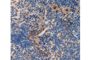 Used in DAB staining on fromalin fixed paraffin- embedded spleen tissue (SMAD6 antibody  (AA 171-441))
