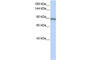 WB Suggested Anti-SOLH Antibody Titration:  0. (Calpain 15/SOLH antibody  (Middle Region))