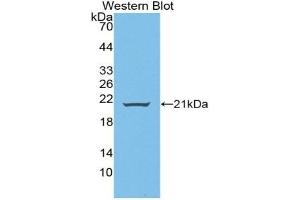 Detection of Recombinant WNT11, Human using Polyclonal Antibody to Wingless Type MMTV Integration Site Family, Member 11 (WNT11) (WNT11 antibody  (AA 204-349))