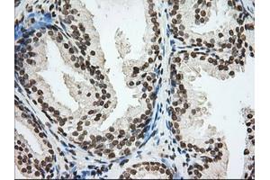 Immunohistochemical staining of paraffin-embedded Human Kidney tissue using anti-CYP1A2 mouse monoclonal antibody.