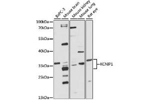 Western blot analysis of extracts of various cell lines, using KCNIP1 antibody (ABIN1873379) at 1:1000 dilution.