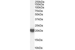 Western Blotting (WB) image for anti-Desert Hedgehog (DHH) (N-Term) antibody (ABIN2788797) (desert Hedgehog antibody  (N-Term))