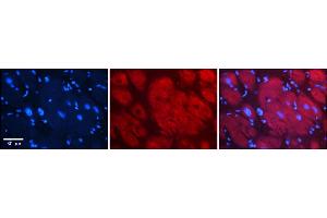 Rabbit Anti-Hdac6 Antibody    Formalin Fixed Paraffin Embedded Tissue: Human Adult heart  Observed Staining: Cytoplasmic Primary Antibody Concentration: 1:600 Secondary Antibody: Donkey anti-Rabbit-Cy2/3 Secondary Antibody Concentration: 1:200 Magnification: 20X Exposure Time: 0. (HDAC6 antibody  (C-Term))