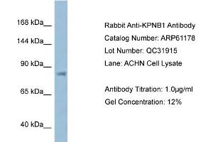 Western Blotting (WB) image for anti-Karyopherin (Importin) beta 1 (KPNB1) (N-Term) antibody (ABIN2788708) (KPNB1 antibody  (N-Term))