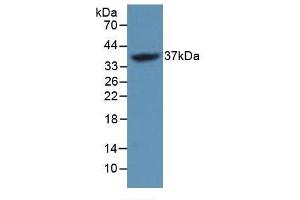 Detection of Recombinant FOSL1, Mouse using Polyclonal Antibody to FOS Like Antigen 1 (FOSL1) (FOSL1 antibody  (AA 1-273))
