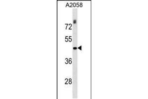 Western blot analysis in A2058 cell line lysates (35ug/lane). (THO Complex 3 antibody  (N-Term))