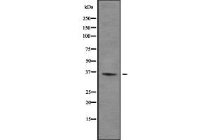 ZFP36L1 antibody  (Internal Region)