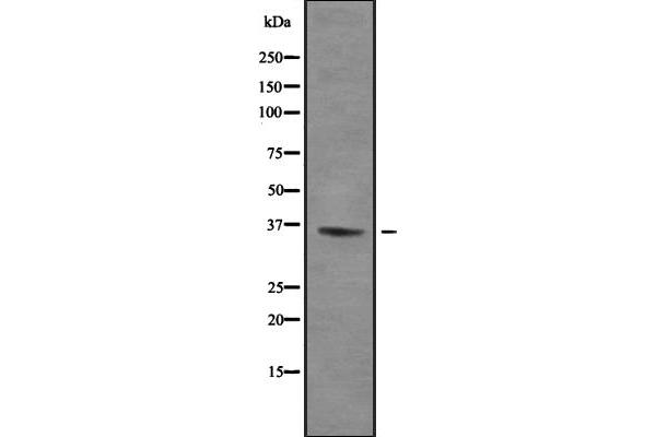 ZFP36L1 antibody  (Internal Region)