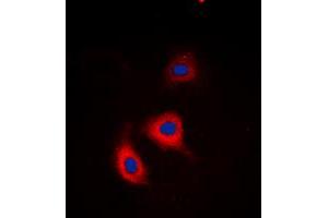 Immunofluorescent analysis of Alpha-adducin (pS726/713) staining in HeLa cells. (alpha Adducin antibody  (C-Term, pSer713, pSer726))