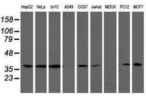 Image no. 6 for anti-Leucine Carboxyl Methyltransferase 1 (LCMT1) antibody (ABIN1499109)
