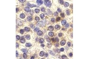 Immunohistochemistry of CX3CR1 in human spleen cells with CX3CR1 antibody at 10 μg/ml. (CX3CR1 antibody  (Extracellular Loop))