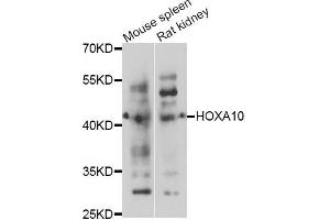 Western blot analysis of extracts of various cell lines, using HOXA10 antibody.