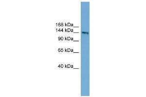 DCC antibody used at 1 ug/ml to detect target protein. (DCC antibody  (Middle Region))