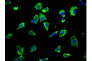 Immunofluorescence staining of SH-SY5Y cells with ABIN7153973 at 1:50, counter-stained with DAPI. (GRIK2 antibody  (AA 203-500))