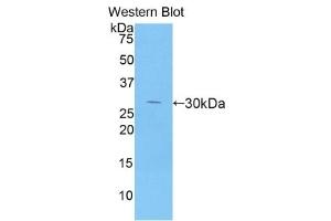 Western Blotting (WB) image for Dipeptidyl-Peptidase 4 (DPP4) ELISA Kit (ABIN6574231)