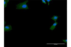 Immunofluorescence of purified MaxPab antibody to SKIV2L on HeLa cell. (SKIV2L antibody  (AA 1-1246))