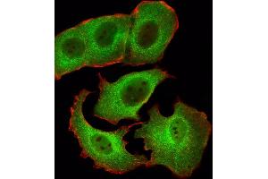 Fluorescent ige of MCF-7 cells stained with SD1 Antibody (Center) (ABIN6242631 and ABIN6577423). (SMAD1 antibody  (AA 163-196))