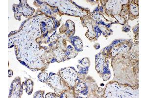 IHC analysis of CD151 using anti- CD151 antibody . (CD151 antibody  (AA 113-175))