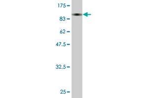 Western Blot detection against Immunogen (95. (PAPOLB antibody  (AA 1-637))