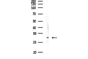 anti-Mitochondrial Ribosomal Protein L46 (MRPL46) (C-Term) antibody