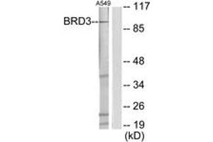 Western blot analysis of extracts from A549 cells, using BRD3 Antibody. (BRD3 antibody  (AA 611-660))