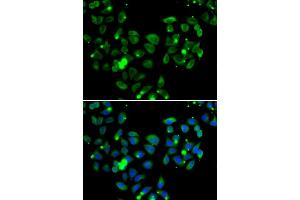 Immunofluorescence analysis of  cells using C antibody (ABIN6127550, ABIN6137939, ABIN6137940 and ABIN6222956). (CARD11 antibody  (AA 985-1154))