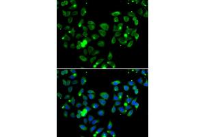Immunofluorescence analysis of  cells using C antibody (ABIN6127550, ABIN6137939, ABIN6137940 and ABIN6222956). (CARD11 antibody  (AA 985-1154))