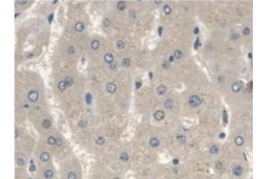 Detection of IGFBP2 in Human Liver Tissue using Polyclonal Antibody to Insulin Like Growth Factor Binding Protein 2 (IGFBP2)