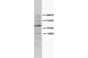 Anti-Cullin 4B antibody, Western blotting WB: Rat Lung Tissue Lysate (Cullin 4B antibody  (C-Term))