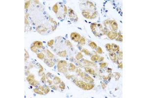 Immunohistochemistry of paraffin-embedded human gastric using RPS2 antibody at dilution of 1:100 (x40 lens).