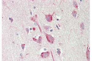 Rabbit Anti-PSAT1 antibody  Formalin Fixed Paraffin Embedded Tissue: Human Brain, Cortex Primary antibody Concentration: 1:100 Secondary Antibody: Donkey anti-Rabbit-Cy3 Secondary Antibody Concentration: 1:200 Magnification: 20x Exposure Time: 0. (PSAT1 antibody  (N-Term))